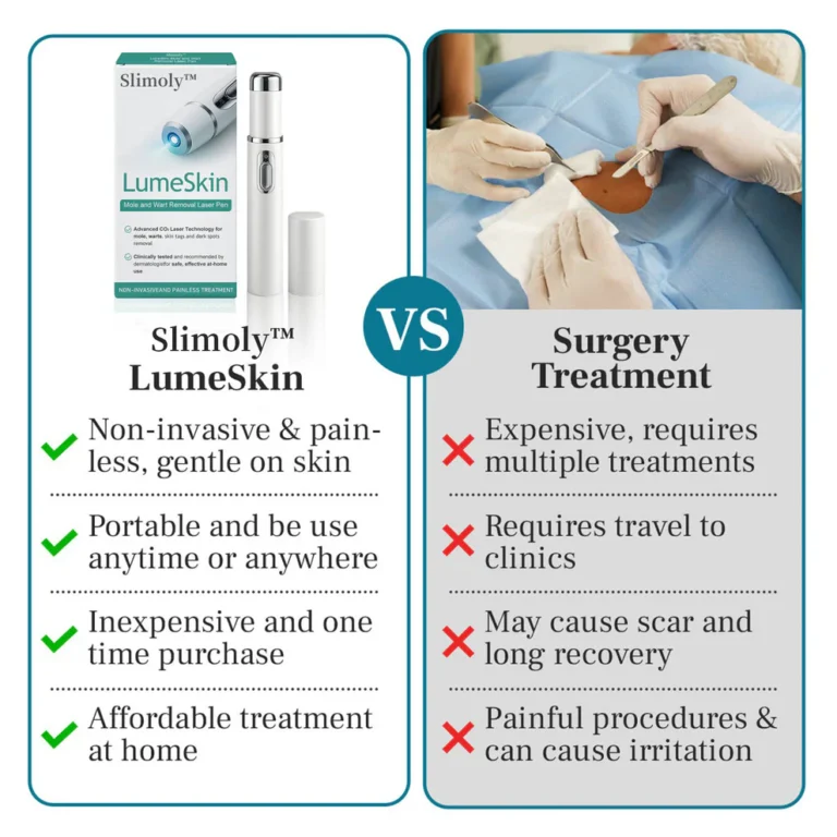 Slimoly™ LumeSkin Mole and Wart Removal Laser Pen image Slimoly™ LumeSkin Mole and Wart Removal Laser Pen