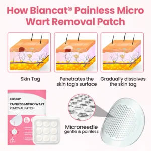 Biancat® Painless Micro Wart Removal Patch image Biancat® Painless Micro Wart Removal Patch