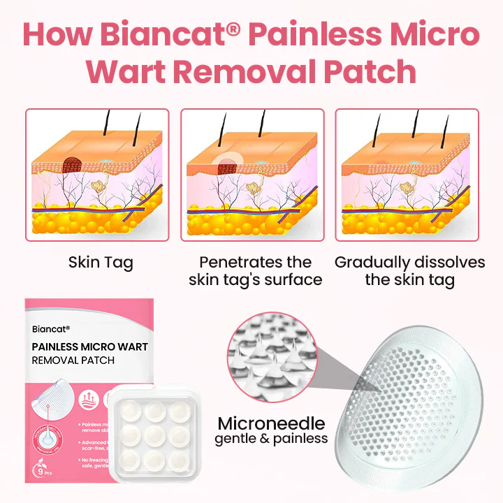 Biancat® Painless Micro Wart Removal Patch image Biancat® Painless Micro Wart Removal Patch - Image 8