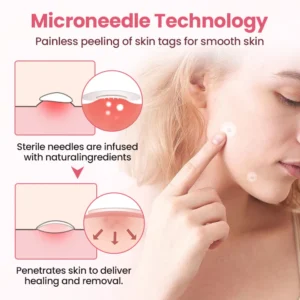 Biancat® Painless Micro Wart Removal Patch image Biancat® Painless Micro Wart Removal Patch