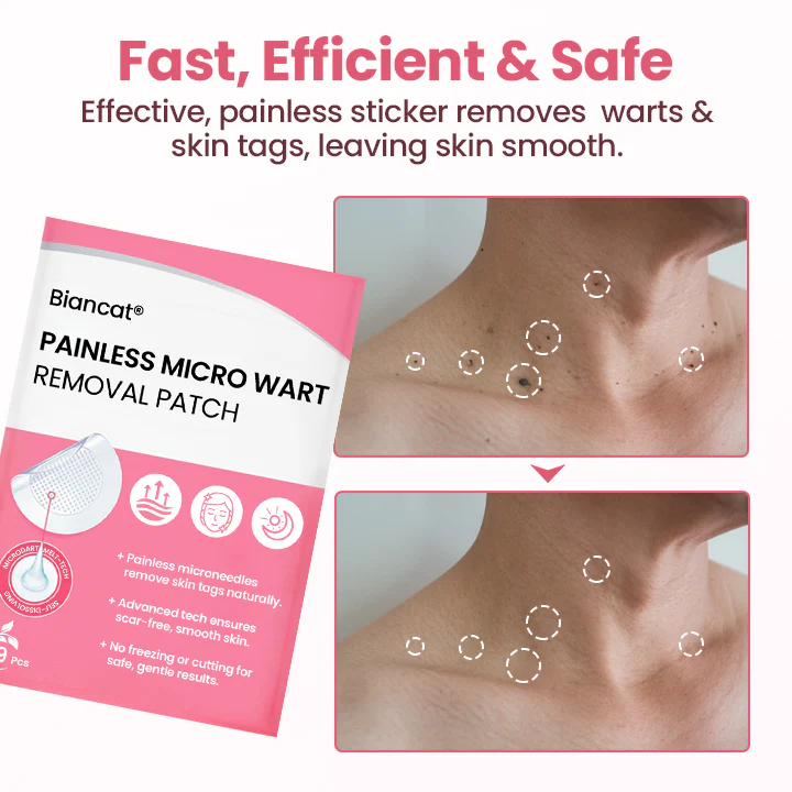 Biancat® Painless Micro Wart Removal Patch image Biancat® Painless Micro Wart Removal Patch