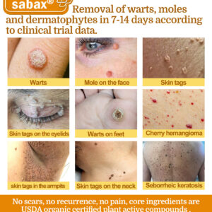 sabax® Bee Venom Comprehensive Cream image sabax® Bee Venom Comprehensive Cream