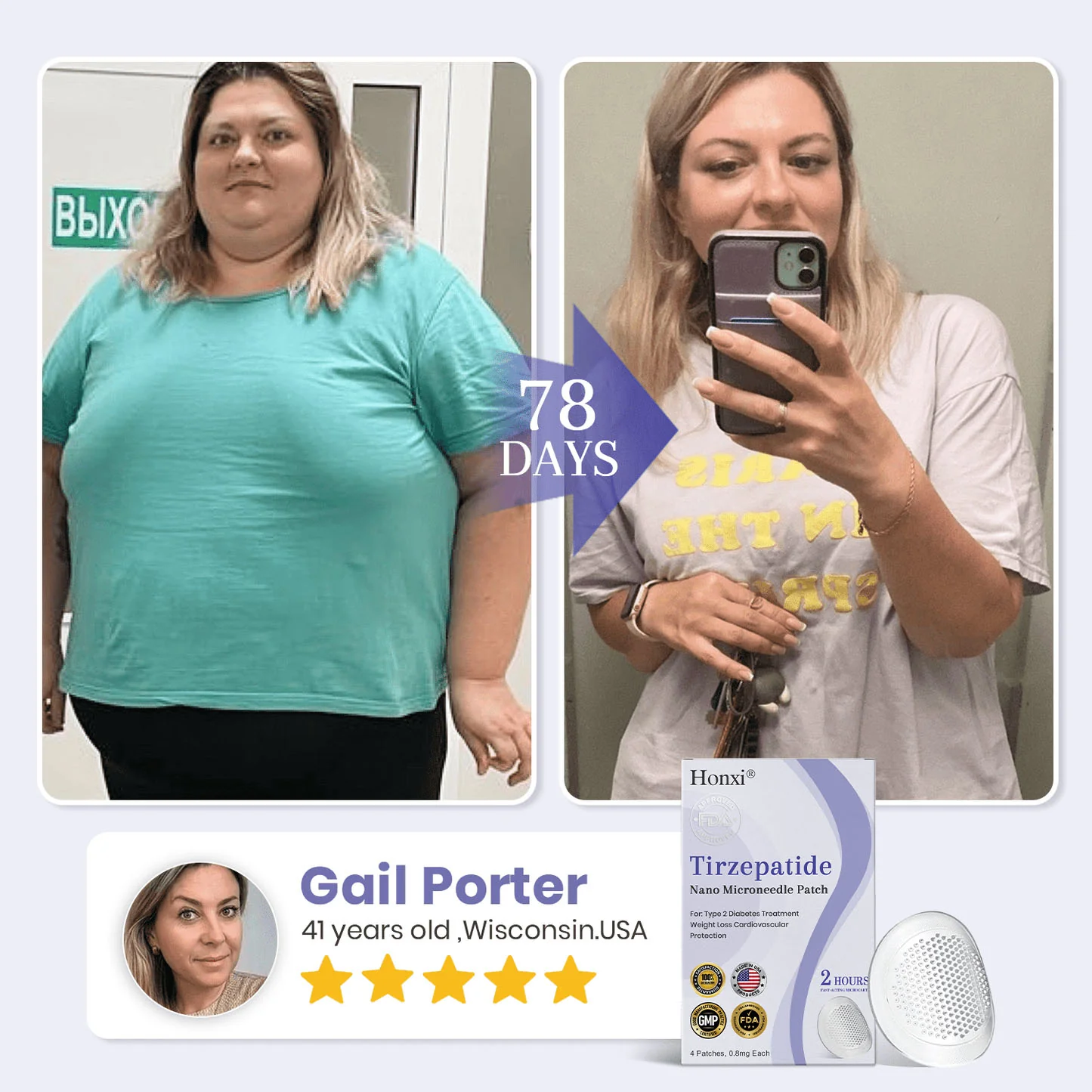 Honxi® NIDDK Tirzepatide Namo Microneedle Patch image Tirzepatide Namo Microneedle Patch