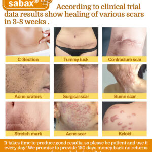 sabax® Bee Venom Comprehensive Cream image sabax® Bee Venom Comprehensive Cream