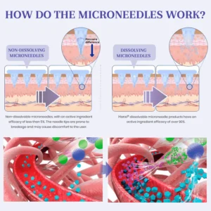 Honxi® NIDDK Tirzepatide Namo Microneedle Patch image Tirzepatide Namo Microneedle Patch