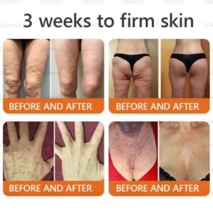 Daasry® "Golden Elixir" Botox Bee Venom Skin Restoration Cream image Daasry® "Golden Elixir" Botox Bee Venom Skin Restoration Cream