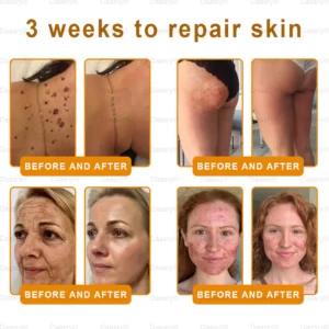 Daasry® "Golden Elixir" Botox Bee Venom Skin Restoration Cream image Daasry® "Golden Elixir" Botox Bee Venom Skin Restoration Cream