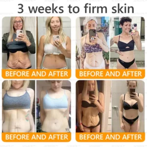 LBMLBM™ Bee venom Comprehensive Cream