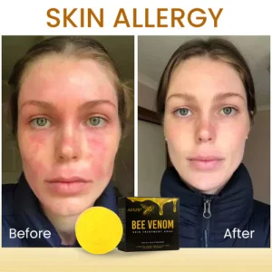 AEXZR® Bee Venom Skin Treatment Soap image AEXZR® Bee Venom Skin Treatment Soap