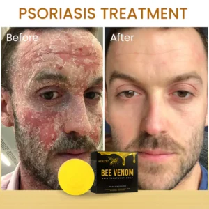 AEXZR® Bee Venom Skin Treatment Soap image AEXZR® Bee Venom Skin Treatment Soap