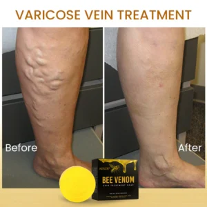 AEXZR® Bee Venom Skin Treatment Soap image AEXZR® Bee Venom Skin Treatment Soap