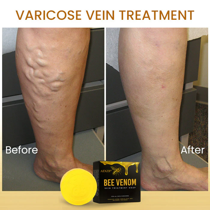 AEXZR® Bee Venom Skin Treatment Soap image AEXZR® Bee Venom Skin Treatment Soap