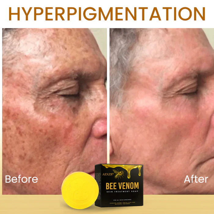 AEXZR® Bee Venom Skin Treatment Soap image AEXZR® Bee Venom Skin Treatment Soap