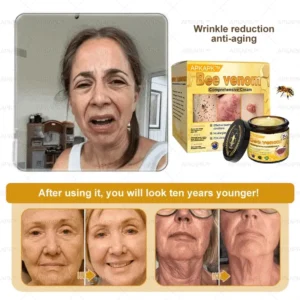 APKAPK™ Bee Venom Skin Treatment Cream