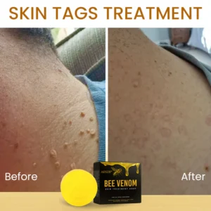 AEXZR® Bee Venom Skin Treatment Soap image AEXZR® Bee Venom Skin Treatment Soap