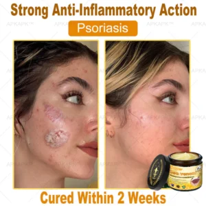 APKAPK™ Bee Venom Skin Treatment Cream
