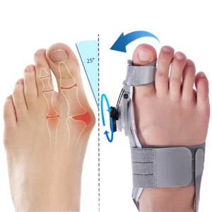 Bonex Bunion Fix