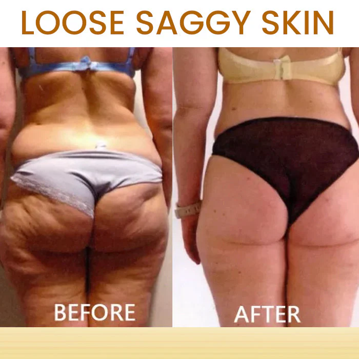 AEXZR® Bee Venom Skin Treatment Soap image AEXZR® Bee Venom Skin Treatment Soap