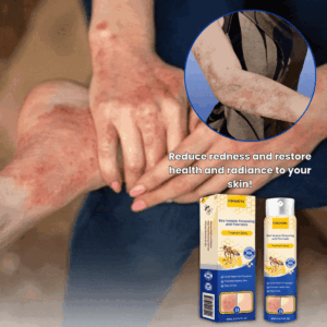 SkinClix™ | Effectively relieves itching and flaking and improves the appearance image SkinClix™ | Effectively relieves itching and flaking and improves the appearance