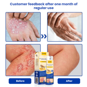 SkinClix™ | Effectively relieves itching and flaking and improves the appearance image SkinClix™ | Effectively relieves itching and flaking and improves the appearance