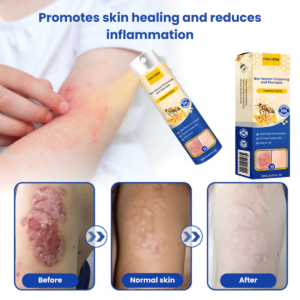 SkinClix™ | Effectively relieves itching and flaking and improves the appearance image SkinClix™ | Effectively relieves itching and flaking and improves the appearance
