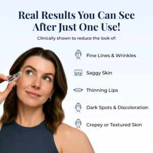 Glamory MicroLift System