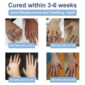 Ourlyard™ Official Store: Magnesium Pain Healing Bone Cream