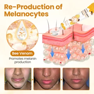 Timilk® VitiCalm Bee Venom Cream