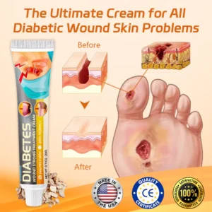 Cvreoz® Diabetes Wound Strong Treatment Cream image Cvreoz® Diabetes Wound Strong Treatment Cream