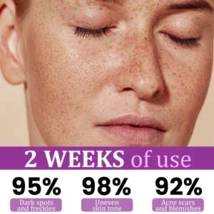 Ceoerty® MelantraX Advanced Anti-Hyperpigmentation Essence image Ceoerty® MelantraX Advanced Anti-Hyperpigmentation Essence