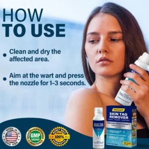 Ourlyard® TagRecede Cryo Treatment Spray