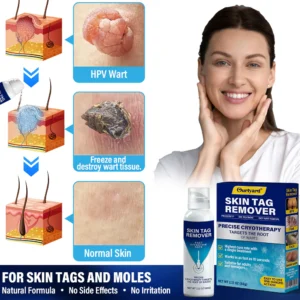 Ourlyard® TagRecede Cryo Treatment Spray