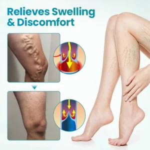 Fivfivgo® VeinEase Soothing Cream