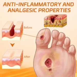 Cvreoz® Diabetes Wound Strong Treatment Cream image Cvreoz® Diabetes Wound Strong Treatment Cream