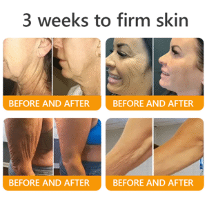 sabax® Bee Venom Comprehensive Cream image sabax® Bee Venom Comprehensive Cream