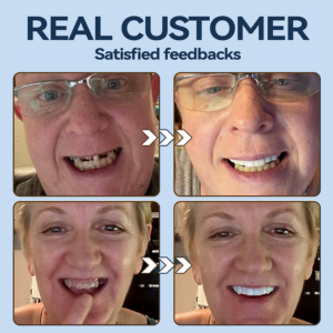 YUNPSO™– Premium Adaptive Dentures