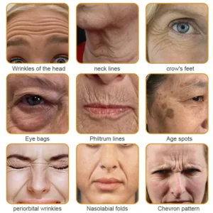 APKAPK™ Bee Venom Skin Treatment Cream