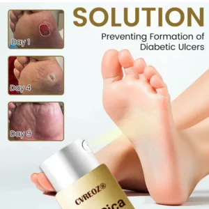 CVREOZ® DiaCure Bee Venom & Centella Diabetic Foot Ulcer Spray image CVREOZ® DiaCure Bee Venom & Centella Diabetic Foot Ulcer Spray