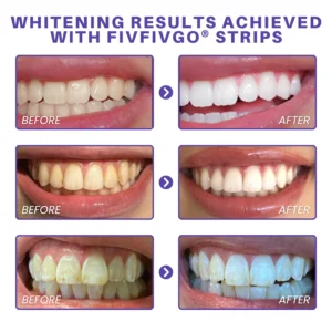 Fivfivgo® Purple Whitening Teeth Strips