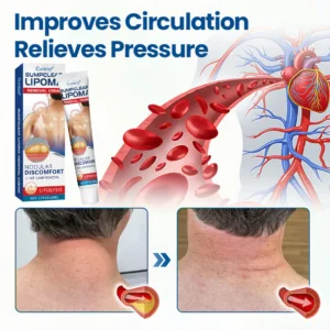 Cvreoz® BumpClear Lipoma Removal Cream