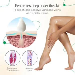 Seurico™ Varicose Vein Relief Cream