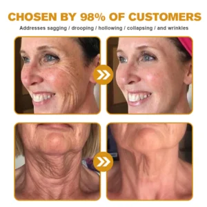 APKAPK™ Bee Venom Skin Treatment Cream