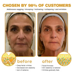 APKAPK™ Bee Venom Skin Treatment Cream