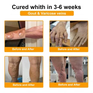 XRLXRL™ Bee Venom Pain-Relief Bone Healing Cream