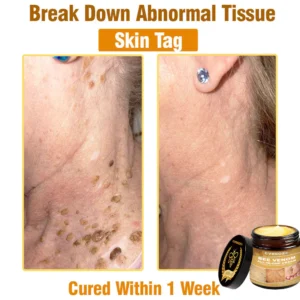 Cvreoz® Bee Venom All-in-One Cream