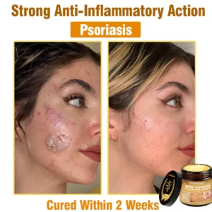 Cvreoz® Bee Venom All-in-One Cream