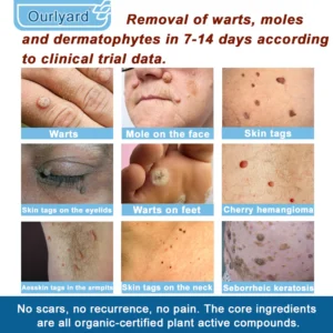 Ourlyard® Magnesium skin repair cream