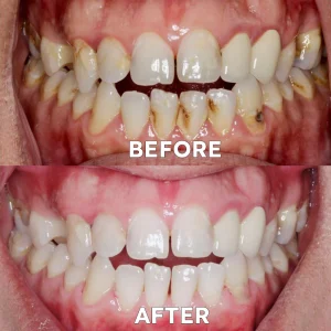 Ourlyard® Tooth Health Mineral Powder