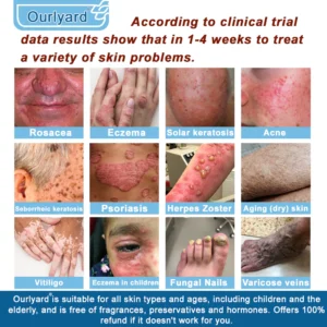 Ourlyard® Magnesium skin repair cream