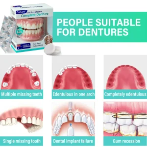 Ourlyard® Suction-fit Complete Denture
